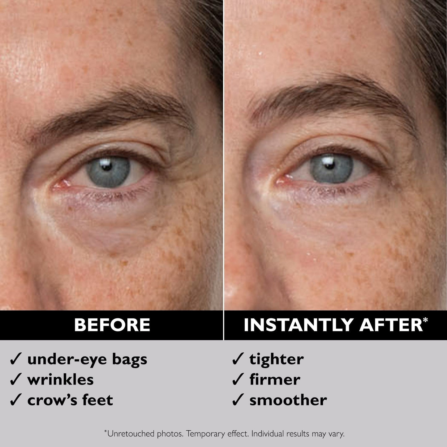 Instant FIRMx Eye Temporary Eye Tightener | 30 ml / 1.0 fl oz